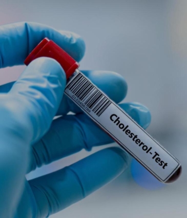 cholesterol-dr-sayan-sen-featured