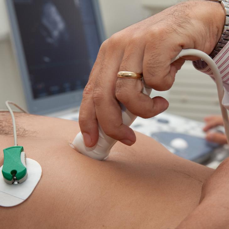 palpitations-dr-sayan-sen-2